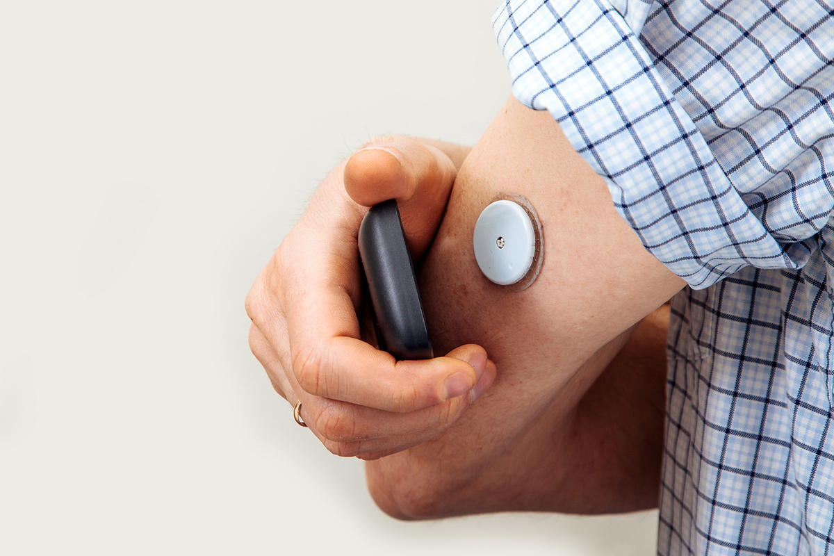 Ambulatory Glucose monitoring